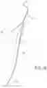 Fig. 11 - Knotless closure sutures and methods of tissue fixation