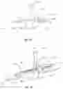Fig. 11 - SUTURELESS DEVICE AND METHOD FOR CLOSING A TISSUE OPENING
