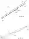 Fig. 25 - Endoscopic hemostatic clipping apparatus