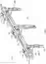 Fig. 03 - Apparatus for incision and removal of osseous tissue and methods thereof