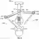 Fig. 12 - Apparatus for incision and removal of osseous tissue and methods thereof