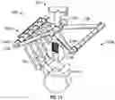 Fig. 13 - Apparatus for incision and removal of osseous tissue and methods thereof