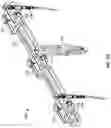 Fig. 15 - Apparatus for incision and removal of osseous tissue and methods thereof