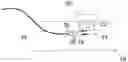 Fig. 01 - METHODS FOR REMOVING CALCIUM FROM PERIPHERAL ARTERY VESSELS