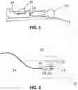 Fig. 02 - METHODS FOR REMOVING CALCIUM FROM PERIPHERAL ARTERY VESSELS