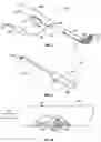 Fig. 04 - DEFLECTABLE GUIDE CATHETERS AND RELATED METHODS