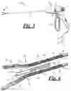 Fig. 02 - Forceps with tissue stops