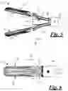 Fig. 04 - Forceps with tissue stops