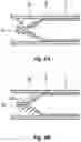 Fig. 08 - Surgical cannula
