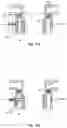 Fig. 16 - Surgical cannula