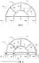 Fig. 02 - System, kit and apparatus for attachment of external fixators for bone realignment