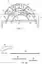Fig. 03 - System, kit and apparatus for attachment of external fixators for bone realignment