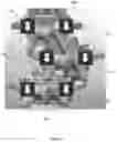 Fig. 06 - Device for Realignment, Stabilization, and Prevention of Progression of Abnormal Spine Curvature