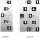Fig. 10 - Device for Realignment, Stabilization, and Prevention of Progression of Abnormal Spine Curvature