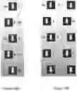 Fig. 17 - Device for Realignment, Stabilization, and Prevention of Progression of Abnormal Spine Curvature