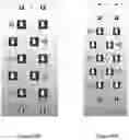 Fig. 27 - Device for Realignment, Stabilization, and Prevention of Progression of Abnormal Spine Curvature
