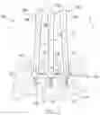 Fig. 05 - Deformable device for minimally invasive fixation
