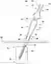 Fig. 01 - Apparatus, system, and method for spinal vertebrae stabilization