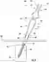 Fig. 04 - Apparatus, system, and method for spinal vertebrae stabilization
