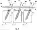 Fig. 09 - Apparatus, system, and method for spinal vertebrae stabilization
