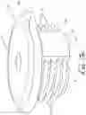 Fig. 08 - Spinal screw assembly with pressure bushing for pre-lock friction fit