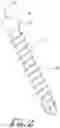 Fig. 03 - Variable angle spinal screw assembly with press fitment bushing