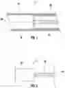 Fig. 02 - Implantable bone adjustment devices