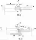 Fig. 07 - Implantable bone adjustment devices