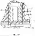 Fig. 20 - BONE CEMENT APPLICATOR