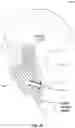 Fig. 16 - Prosthesis installation