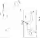 Fig. 17 - Prosthesis installation