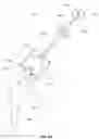 Fig. 20 - Prosthesis installation