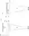 Fig. 32 - Prosthesis installation