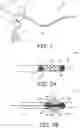 Fig. 02 - ELECTROSURGICAL DEVICE