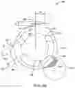 Fig. 05 - Arthroscopic devices and methods