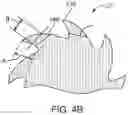 Fig. 06 - Arthroscopic devices and methods