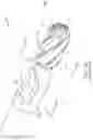 Fig. 07 - Arthroscopic devices and methods