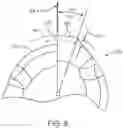 Fig. 09 - Arthroscopic devices and methods
