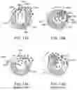 Fig. 17 - Arthroscopic devices and methods