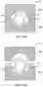 Fig. 18 - Arthroscopic devices and methods