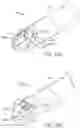 Fig. 28 - Arthroscopic devices and methods