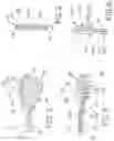 Fig. 03 - Method and apparatus for percutaneous epicardial ablation of cardiac ganglionated plexi without myocardial injury