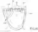 Fig. 09 - Method and apparatus for percutaneous epicardial ablation of cardiac ganglionated plexi without myocardial injury
