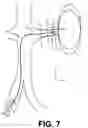 Fig. 08 - Characterizing behavior of anatomical structures