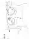 Fig. 30 - Surgical instrument with robotic and manual actuation features