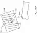 Fig. 25 - Surgical manipulator and method for controlling pose of an instrument based on virtual rigid body modelling