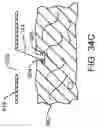 Fig. 49 - Surgical manipulator and method for controlling pose of an instrument based on virtual rigid body modelling