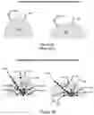 Fig. 04 - IMPLANTABLE MARKERS TO AID SURGICAL OPERATIONS