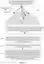 Fig. 14 - IMPLANTABLE MARKERS TO AID SURGICAL OPERATIONS