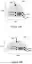 Fig. 17 - IMPLANTABLE MARKERS TO AID SURGICAL OPERATIONS